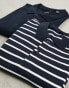 Only & Sons 2 pack polo in navy and navy stripe